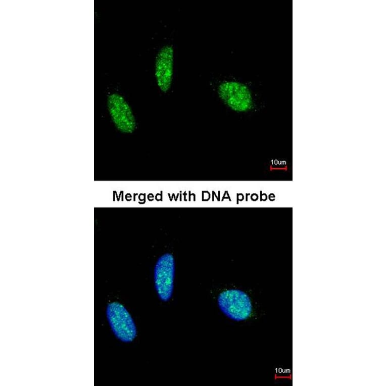 Immunofluorescence - RBM15 antibody from Signalway Antibody (22551) - Antibodies.com