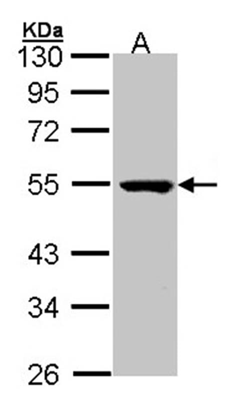 Sample (30 µg of whole cell lysate) Molt-4 10 % SDS PAGE Primary antibody diluted at 1: 1000