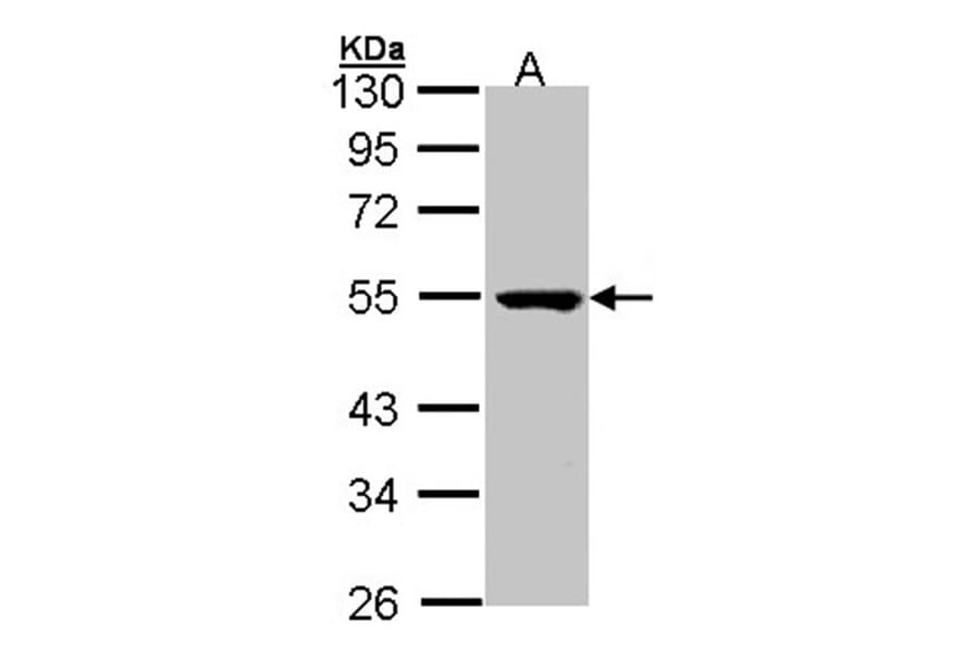 PSKH1 antibody from Signalway Antibody (22580) - Antibodies.com