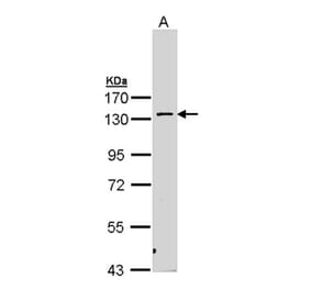PRK2 antibody from Signalway Antibody (22595) - Antibodies.com