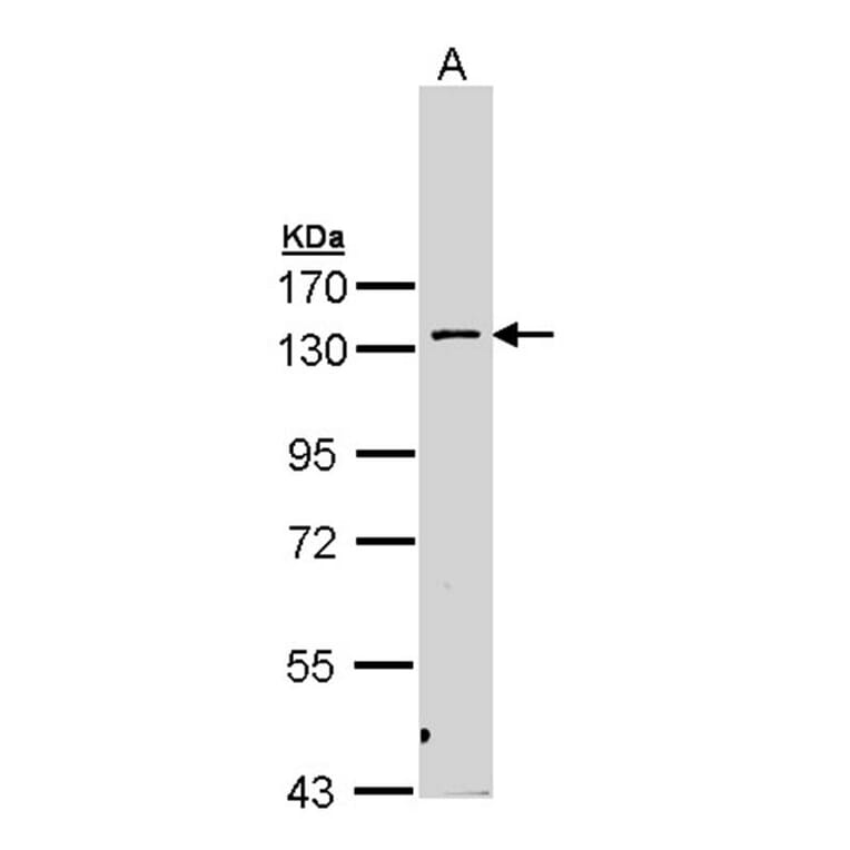 PRK2 antibody from Signalway Antibody (22595) - Antibodies.com