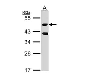 STK24 antibody from Signalway Antibody (22608) - Antibodies.com