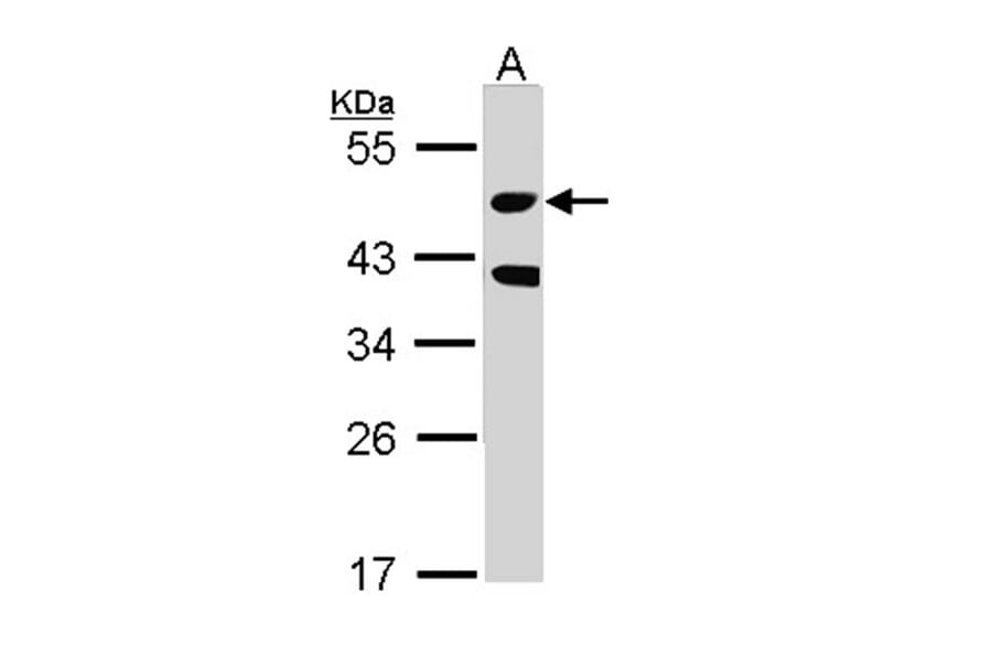 STK24 antibody from Signalway Antibody (22608) - Antibodies.com