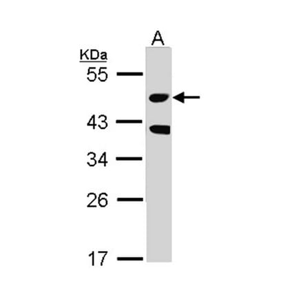 STK24 antibody from Signalway Antibody (22608) - Antibodies.com