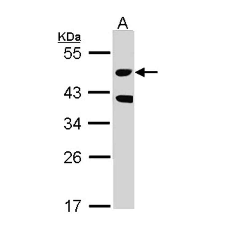 STK24 antibody from Signalway Antibody (22608) - Antibodies.com