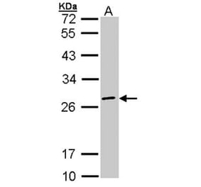 eIF3K antibody from Signalway Antibody (22622) - Antibodies.com