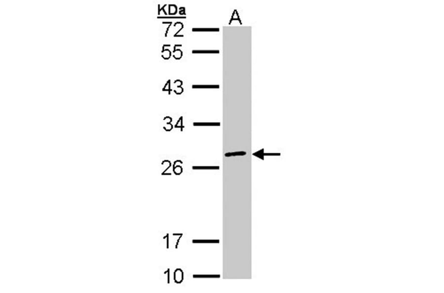 eIF3K antibody from Signalway Antibody (22622) - Antibodies.com