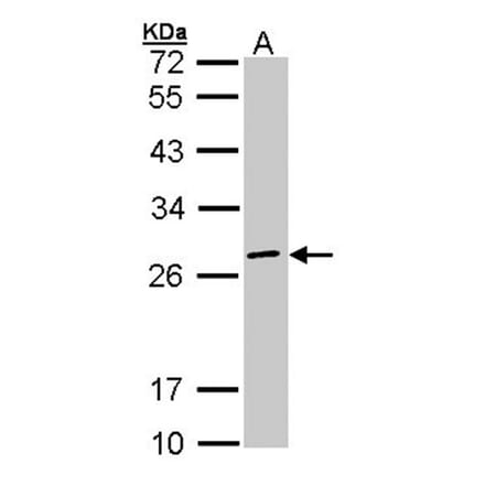 eIF3K antibody from Signalway Antibody (22622) - Antibodies.com