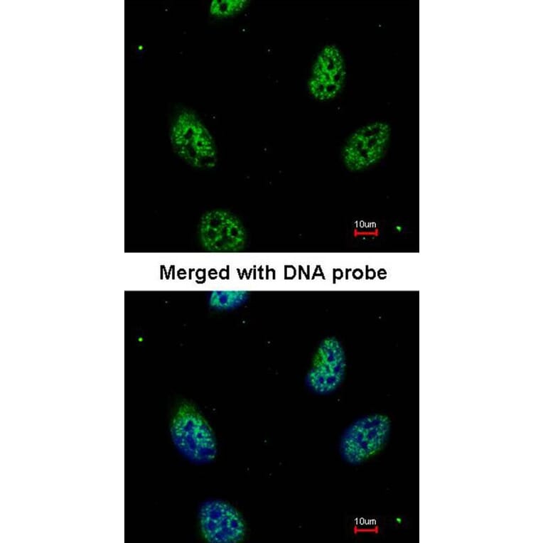 Immunofluorescence - eIF3K antibody from Signalway Antibody (22622) - Antibodies.com