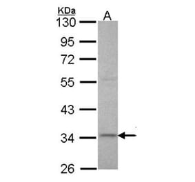 XRCC3 antibody from Signalway Antibody (22662) - Antibodies.com