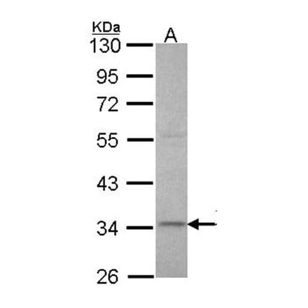 XRCC3 antibody from Signalway Antibody (22662) - Antibodies.com