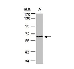 TESK2 antibody from Signalway Antibody (22740) - Antibodies.com