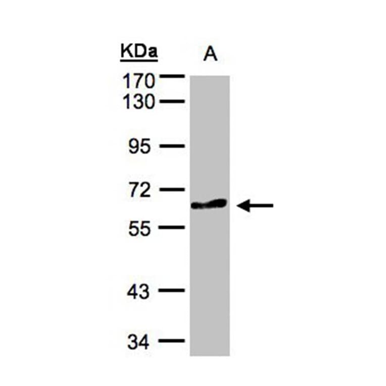 TESK2 antibody from Signalway Antibody (22740) - Antibodies.com