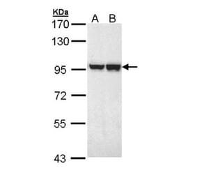 MALT1 antibody from Signalway Antibody (22761) - Antibodies.com