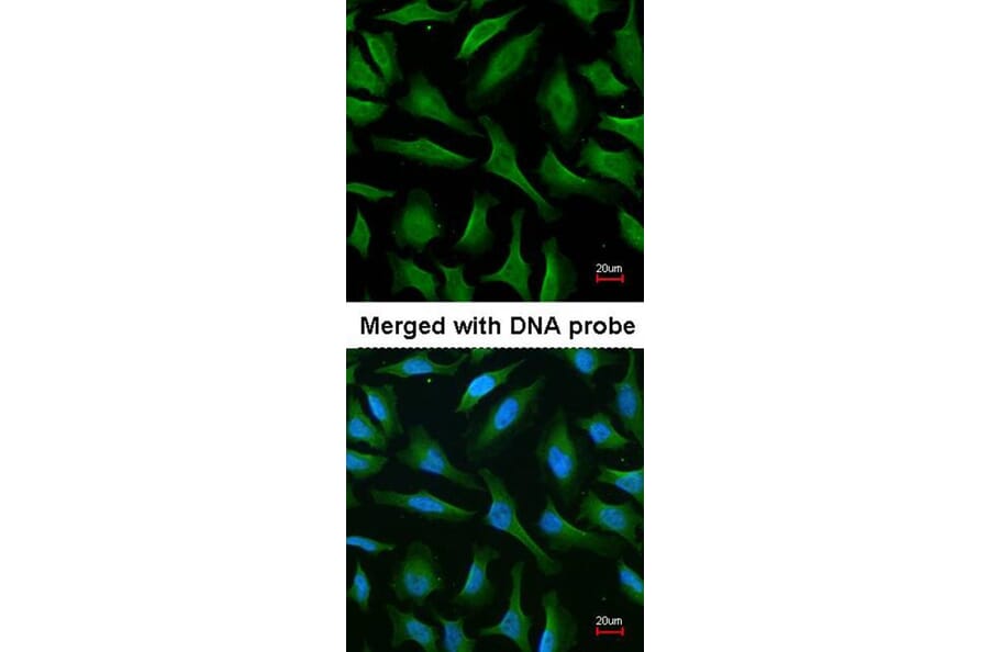 Immunofluorescence - MALT1 antibody from Signalway Antibody (22761) - Antibodies.com