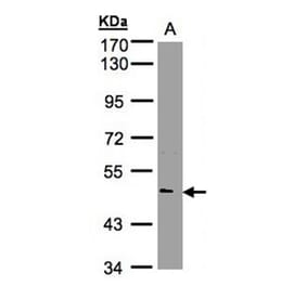 NOVA1 antibody from Signalway Antibody (22767) - Antibodies.com
