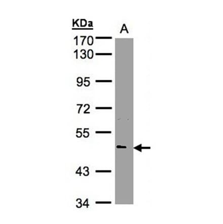 NOVA1 antibody from Signalway Antibody (22767) - Antibodies.com