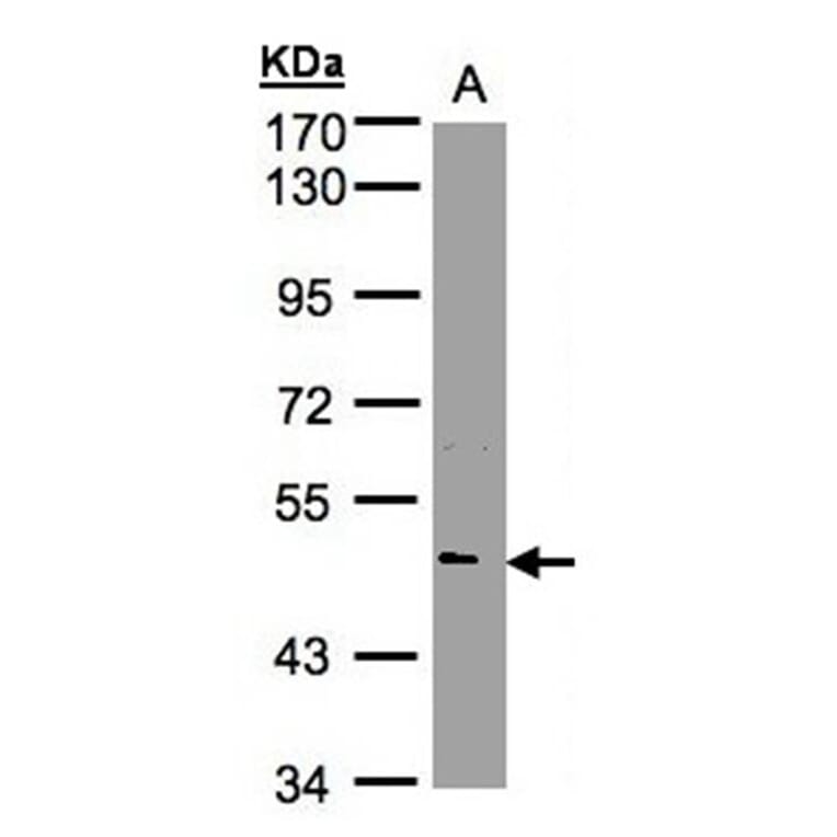 NOVA1 antibody from Signalway Antibody (22767) - Antibodies.com