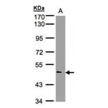 NOVA1 antibody from Signalway Antibody (22767) - Antibodies.com