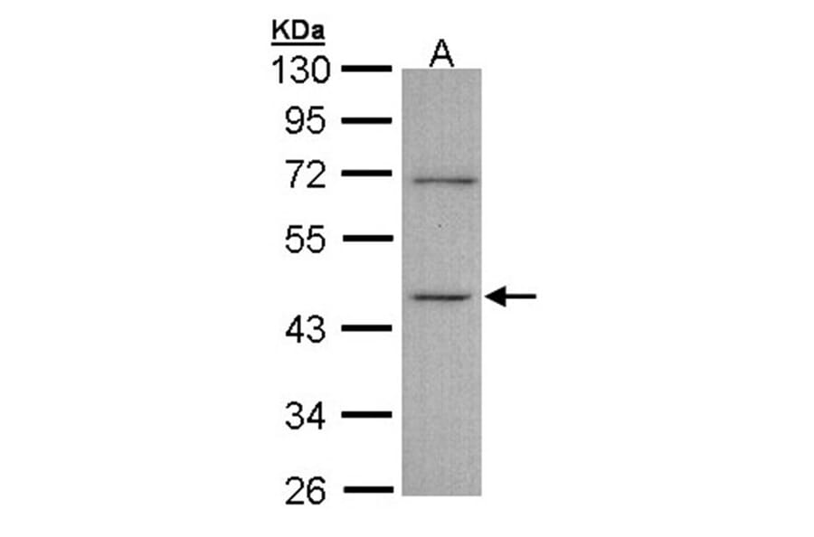 ITPK1 antibody from Signalway Antibody (22783) - Antibodies.com