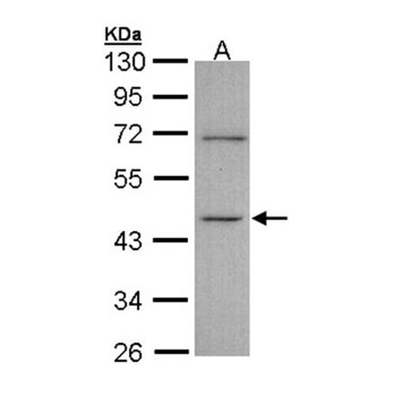 ITPK1 antibody from Signalway Antibody (22783) - Antibodies.com