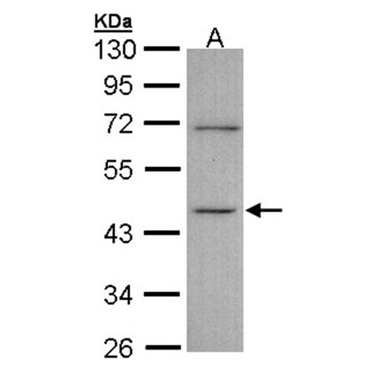 ITPK1 antibody from Signalway Antibody (22783) - Antibodies.com
