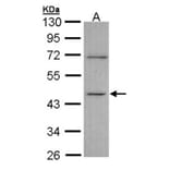 ITPK1 antibody from Signalway Antibody (22783) - Antibodies.com