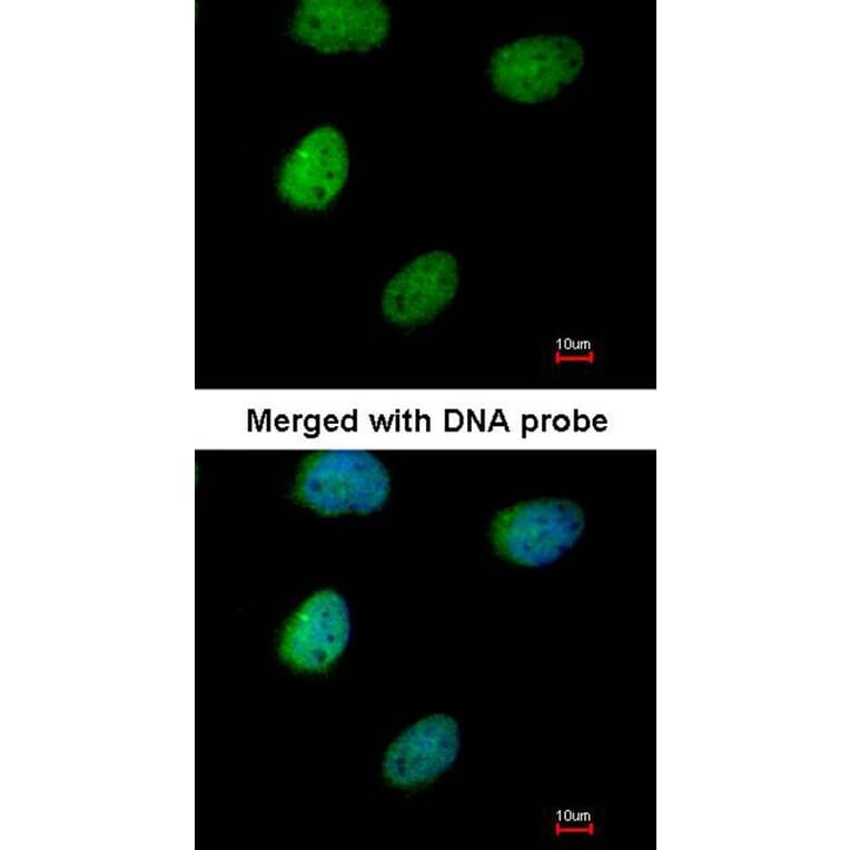 Immunofluorescence - ITPK1 antibody from Signalway Antibody (22783) - Antibodies.com