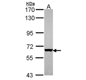 MUS81 antibody from Signalway Antibody (22808) - Antibodies.com