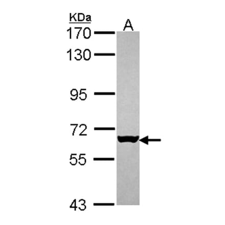 MUS81 antibody from Signalway Antibody (22808) - Antibodies.com