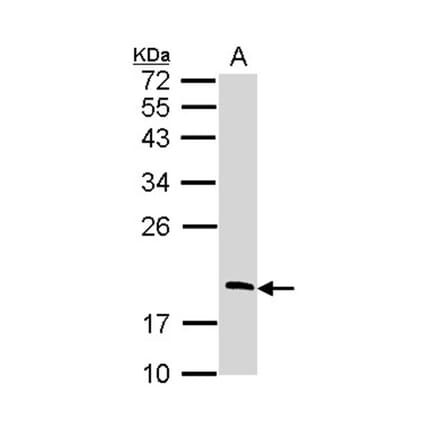RGS13 antibody from Signalway Antibody (22810) - Antibodies.com