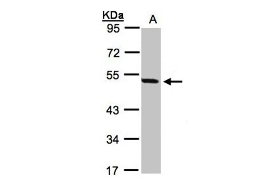 PAX8C antibody from Signalway Antibody (22815) - Antibodies.com