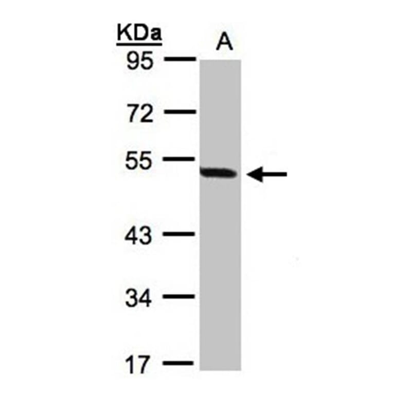 PAX8C antibody from Signalway Antibody (22815) - Antibodies.com