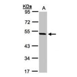 PAX8C antibody from Signalway Antibody (22815) - Antibodies.com