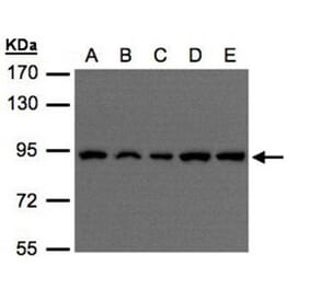 VPS35 antibody from Signalway Antibody (22838) - Antibodies.com