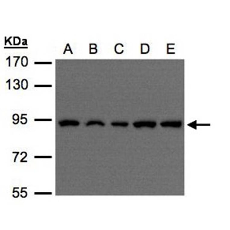 VPS35 antibody from Signalway Antibody (22838) - Antibodies.com