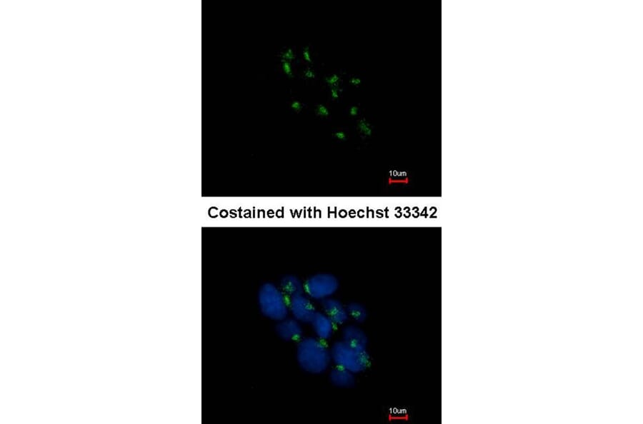 Immunofluorescence - VPS35 antibody from Signalway Antibody (22838) - Antibodies.com