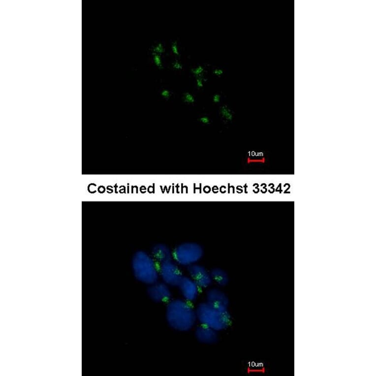 Immunofluorescence - VPS35 antibody from Signalway Antibody (22838) - Antibodies.com