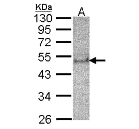 SOCS4 antibody from Signalway Antibody (22880) - Antibodies.com