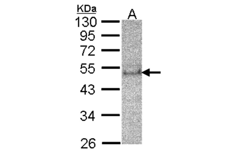 SOCS4 antibody from Signalway Antibody (22880) - Antibodies.com