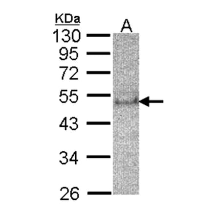 SOCS4 antibody from Signalway Antibody (22880) - Antibodies.com