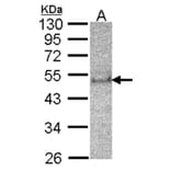 SOCS4 antibody from Signalway Antibody (22880) - Antibodies.com