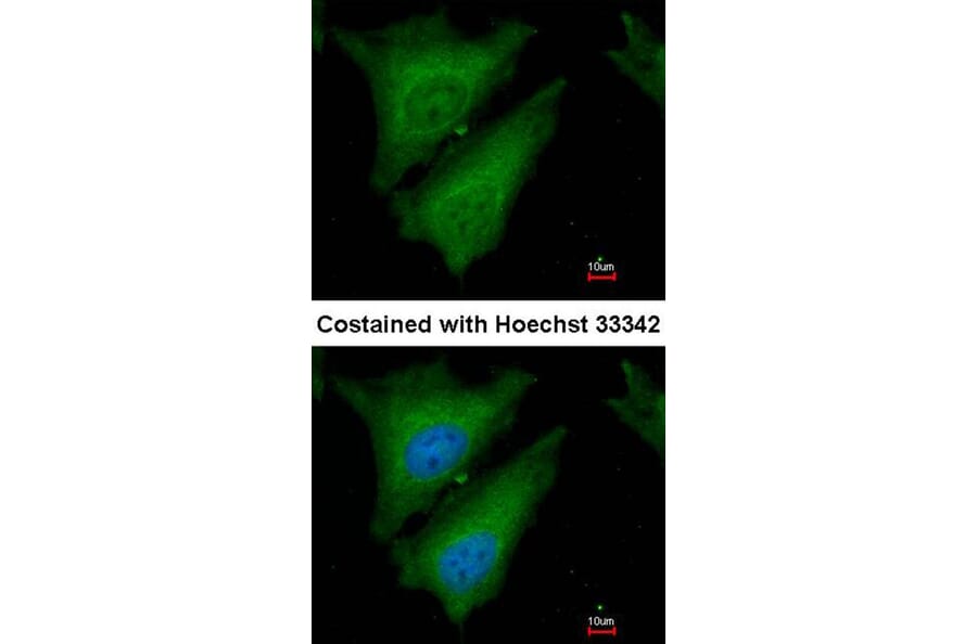 Immunofluorescence - SOCS4 antibody from Signalway Antibody (22880) - Antibodies.com