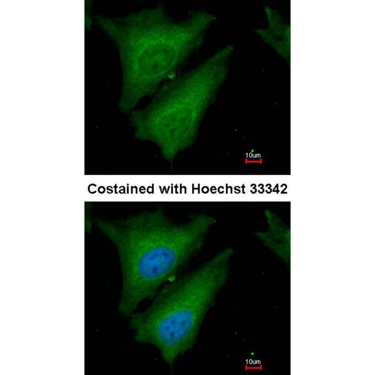 Immunofluorescence - SOCS4 antibody from Signalway Antibody (22880) - Antibodies.com