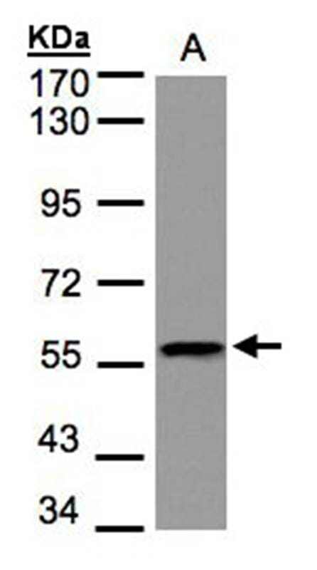 Sample (30 µg of whole cell lysate) Raji 7.5% SDS PAGE Primary antibody diluted at 1: 1000