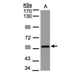DUSP8 antibody from Signalway Antibody (22914) - Antibodies.com