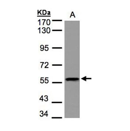 DUSP8 antibody from Signalway Antibody (22914) - Antibodies.com