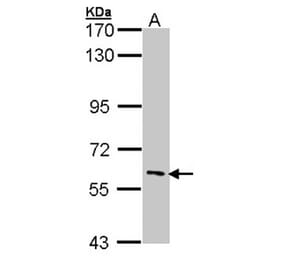 IRAK3 antibody from Signalway Antibody (22926) - Antibodies.com