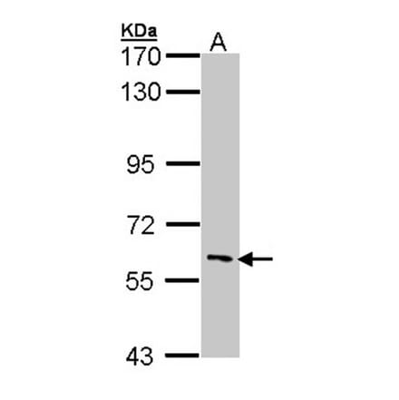 IRAK3 antibody from Signalway Antibody (22926) - Antibodies.com