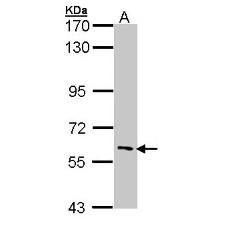 IRAK3 antibody from Signalway Antibody (22926) - Antibodies.com